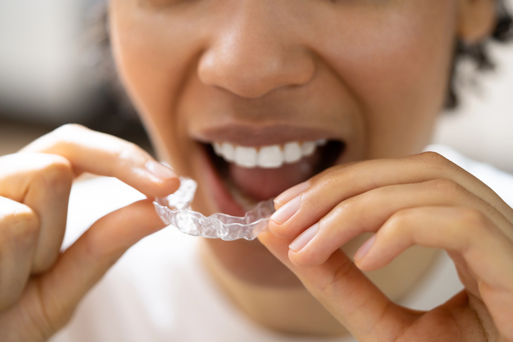 Invisalign in Flat Rock